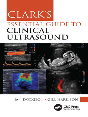 cover image of Clark's Essential Guide to Clinical Ultrasound